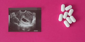 Abortus - Droom Betekenis En Symboliek 44