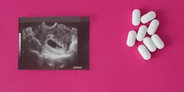 Abortus - Droom Betekenis En Symboliek 5